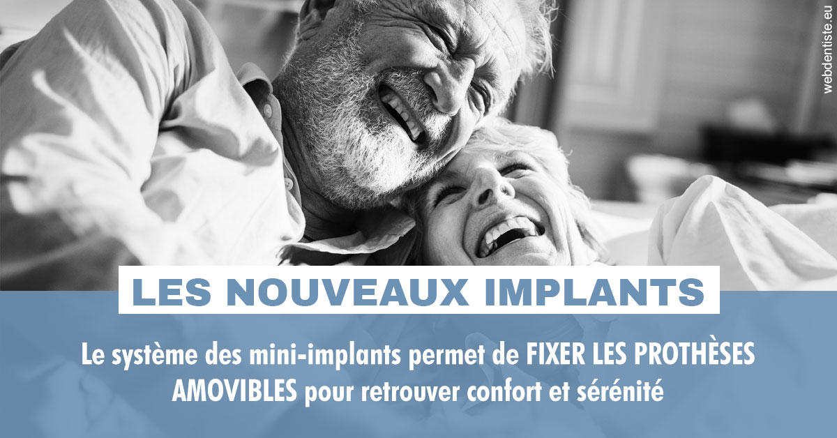 https://dr-david-temstet.chirurgiens-dentistes.fr/Les nouveaux implants 2