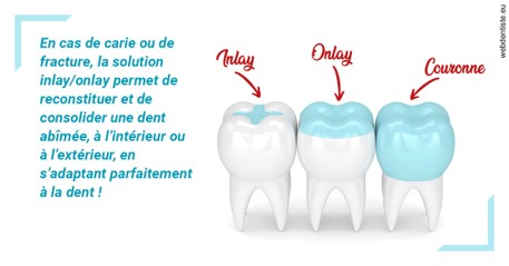 https://dr-david-temstet.chirurgiens-dentistes.fr/L'INLAY ou l'ONLAY