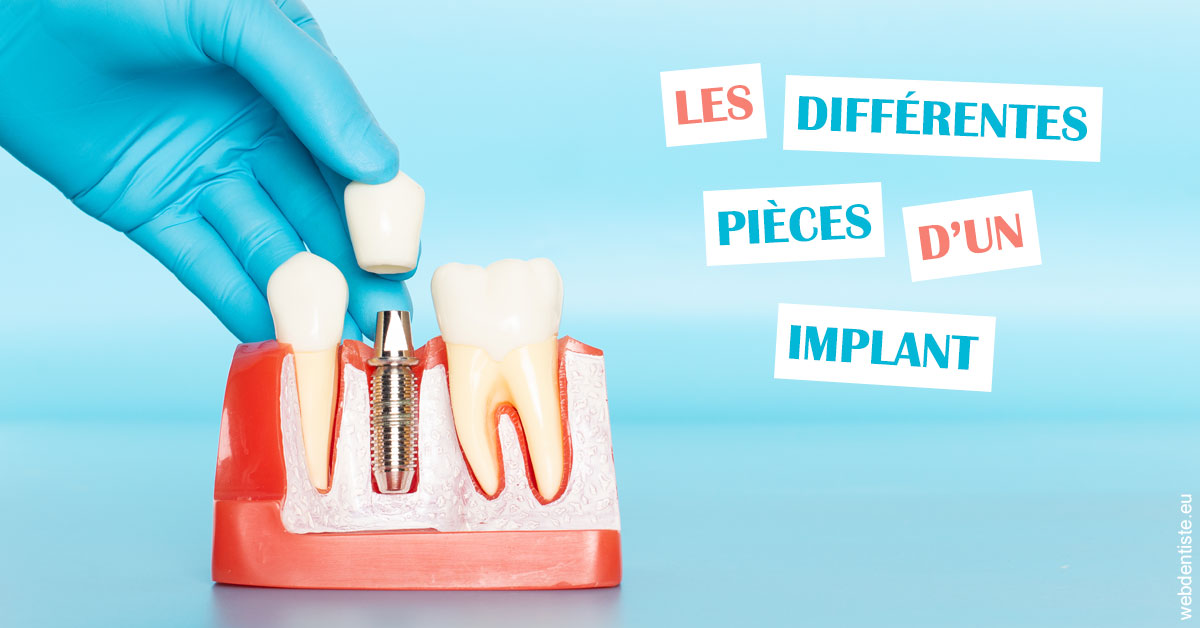 https://dr-david-temstet.chirurgiens-dentistes.fr/Les différentes pièces d’un implant 2