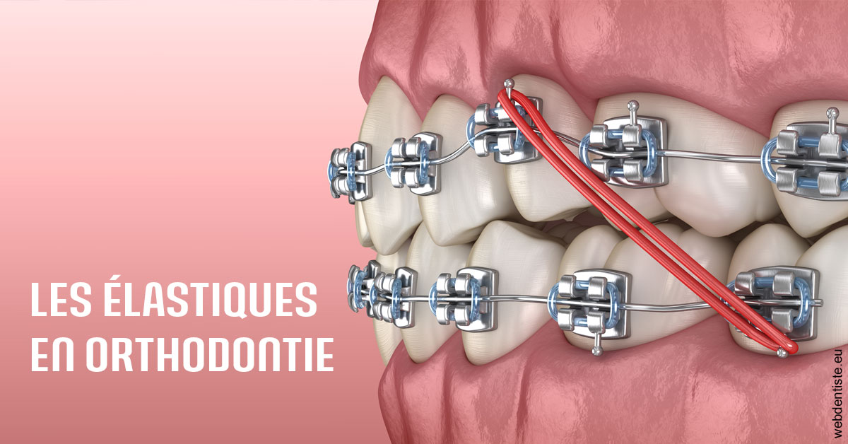 https://dr-david-temstet.chirurgiens-dentistes.fr/Elastiques orthodontie 2