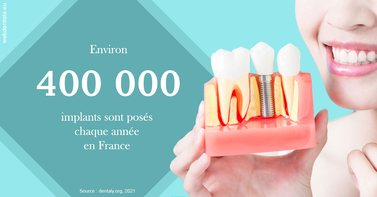 https://dr-david-temstet.chirurgiens-dentistes.fr/Pose d'implants en France 2